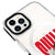 iPhone 16 Pro Sweet Dogs Telefon Kılıfı - Magsafeli Artycase - Siyah