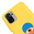 XİAOMİ REDMİ NOTE 10 Oliz Eye Telefon Kılıfı - Renkli Silikon - Sarı